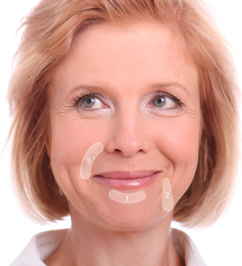 sculptra miami dermatologist