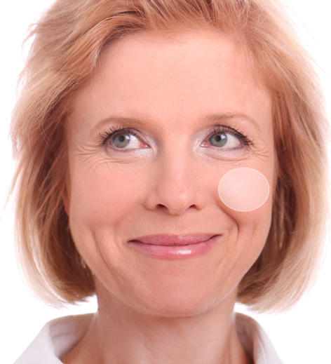 juvederm voluma cost cheeks filler